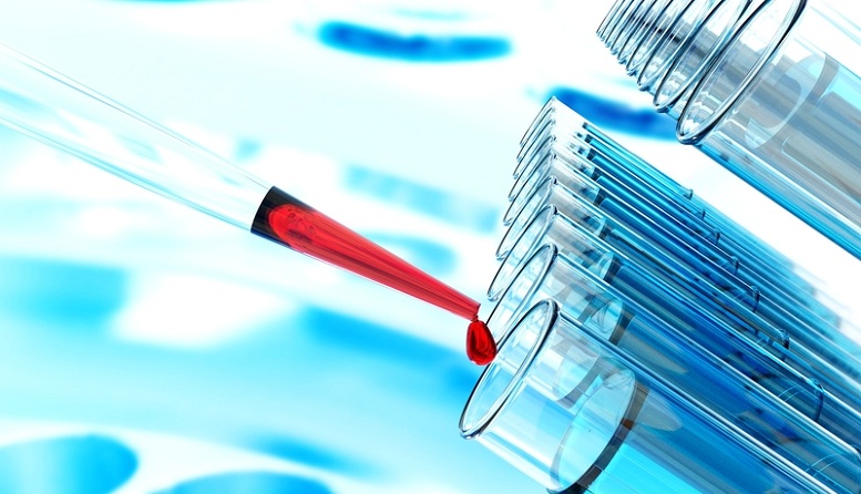 abae536b487fde1f0ccca9ab5cb7ecba Beactica與KU Leuven獲歐洲創新理事會250萬歐元資金,推動孤兒藥BEA-17達到臨床就緒狀態