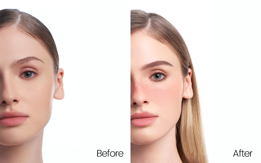 Before and after comparison showing the effect of UNICOS Freckle Pen.